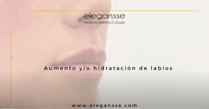 Diseño de Labios con Ácido Hialurónico