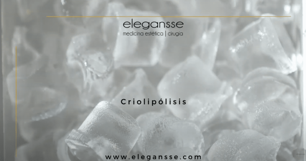 Criolipólisis para eliminar grasa localizada: Transforma tu silueta en Elegansse Medicina Estética