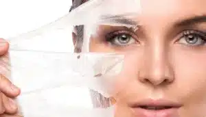 peeling químico para la piel