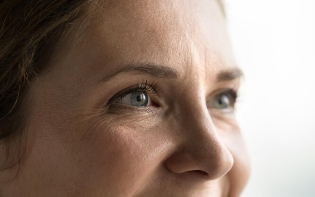 Bioplasma para arrugas en los ojos