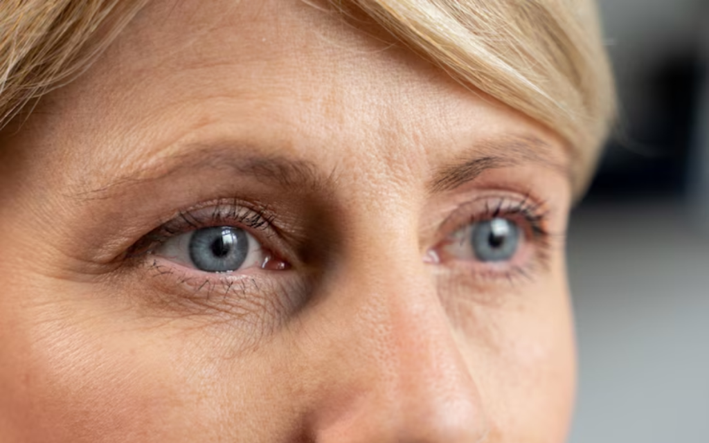 Dermapen arrugas en los ojos BARCELONA
