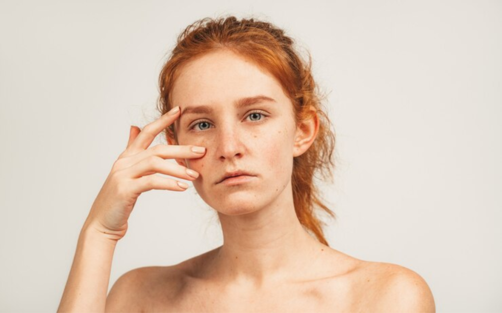Dudas tratamiento ojeras Barcelona