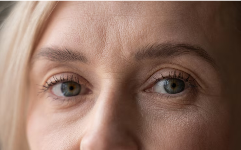 Neuromodulador para arrugas en los ojos BARCLONA