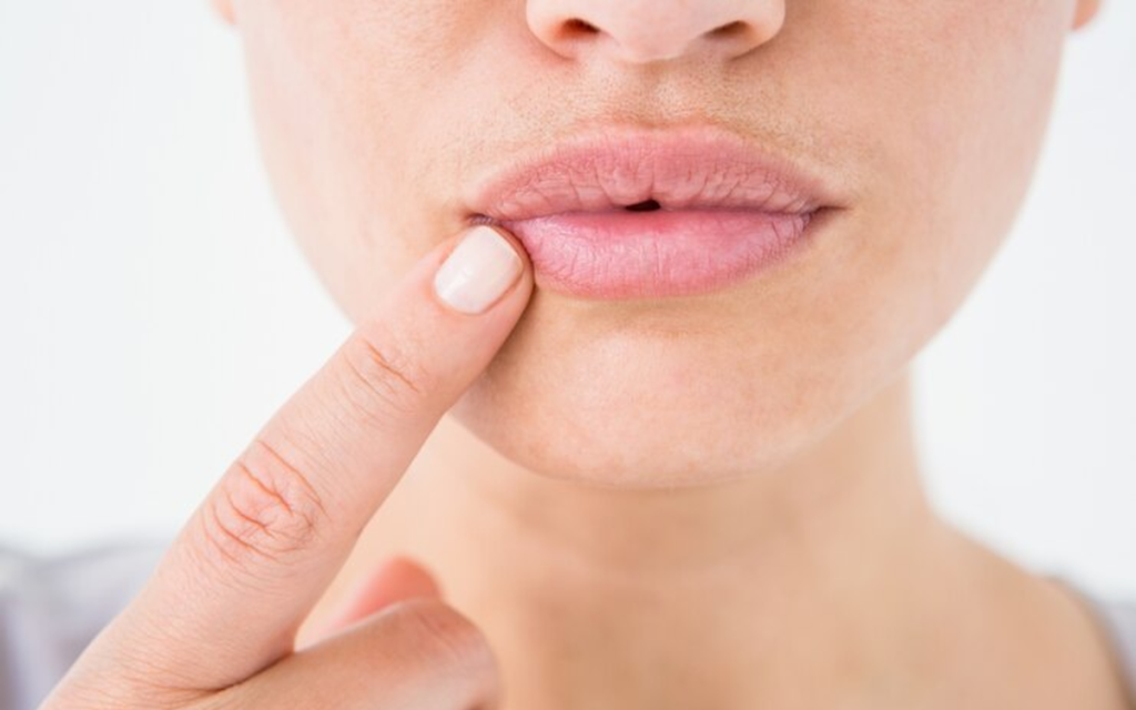 Peeling químico médico para labios deshidratados BARCELONA