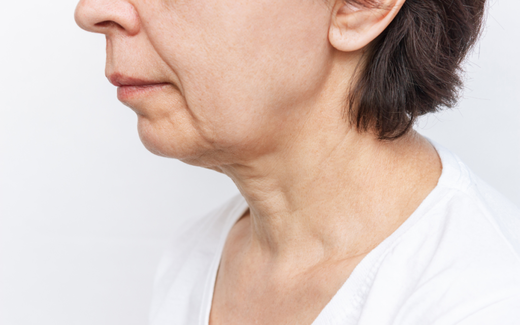 Tratamiento para Jowls Tratamiento facial Barcelona