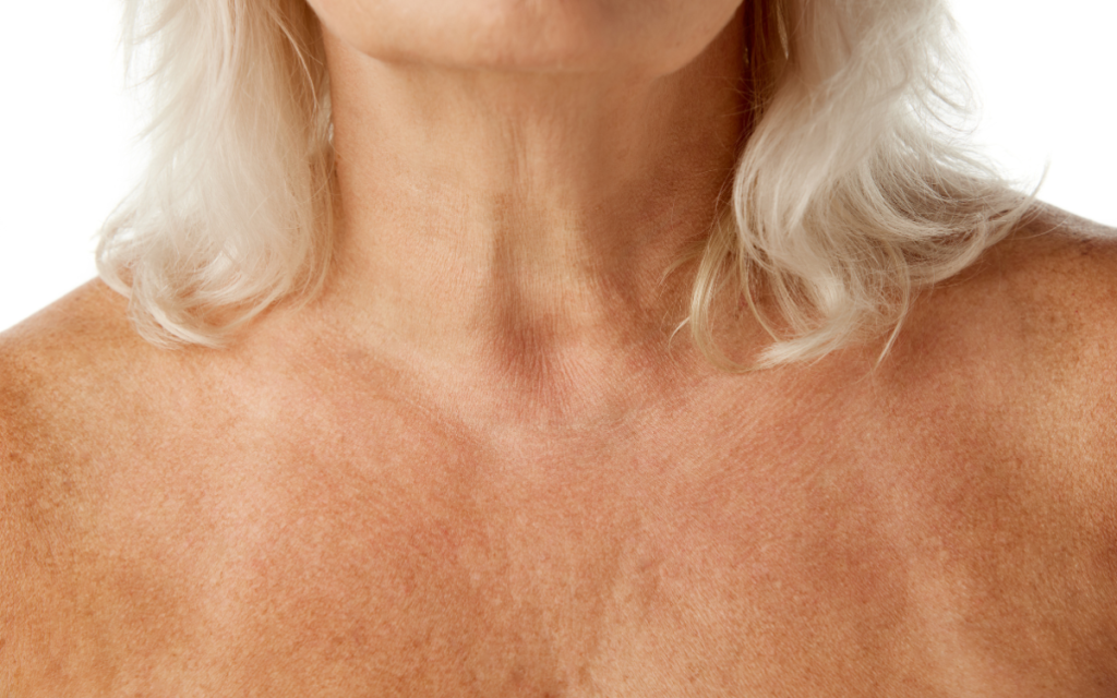 Tienes más dudas sobre el tratamiento para la pigmentación del cuello en Barcelona
